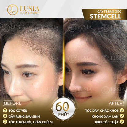 Cấy tế bào gốc STEMCELL